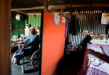 When hospitals don’t make the cut Fight the rot: With both her feet now amputated