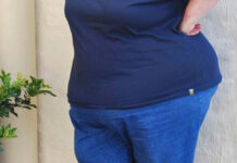 My controversial 100kg revolution Santie Pretorius lost more than 100kg after undergoing bariatric surgery
