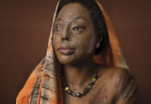 Acid attacks: ‘I didn’t have the money to buy justice, but I had brains to go on’ Acid victim Hanifa Nakiryowa founded the Center for Rehabilitation of Survivors of Acid and Burns Violence.
