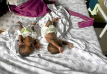 Yay for SA’s child health policies, nay for outcomes A drug could save the lives of premature babies