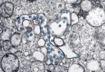 The World Health Organisation’s Solidarity trial testing possible COVID-19 treatments Microscopic image of an isolate from the first U.S. case of COVID-19