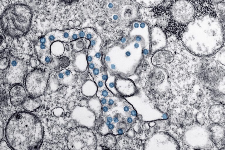 The World Health Organisation’s Solidarity trial testing possible COVID-19 treatments