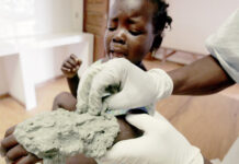Buruli ulcer: Africa’s neglected but third most common mycobacterial disease A nurse treats a young patient's buruli ulcer with a clay poultice.