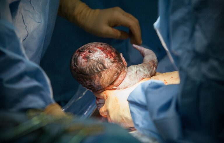 Why medical aids are putting the price of a safe delivery on some women’s pockets