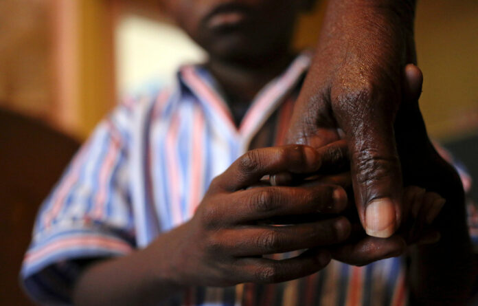 Despite a strong HIV programme response