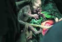 Caesarean vs vaginal birth: A mother’s choice, not her doctor’s It's not only women who prefer Caesarean sections
