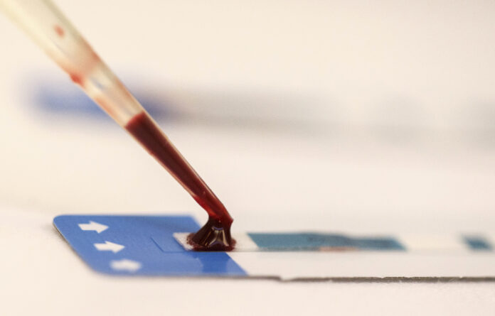 Shortages of HIV testing kits put lives of raped survivors in danger.
