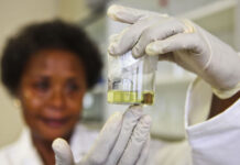 Scientists have tools to fight HIV, but we need more Since the early 2000s