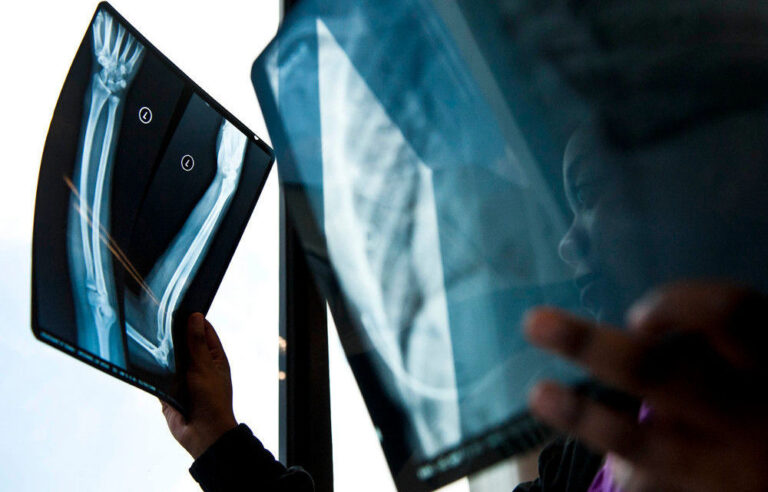 Publicly waiting for x-rays, privately abandoning all hope