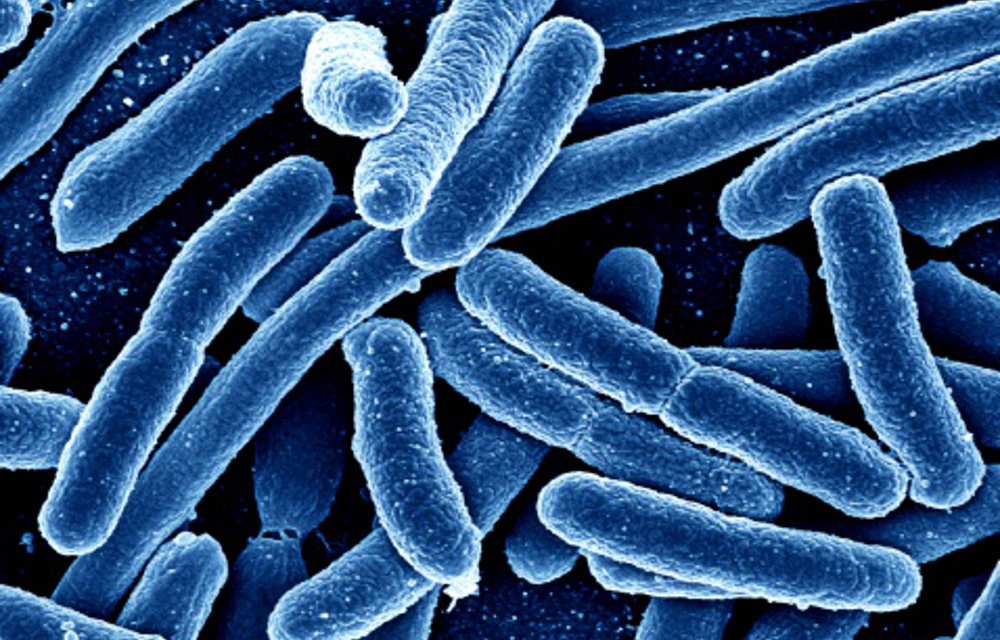 E. coli bacteria