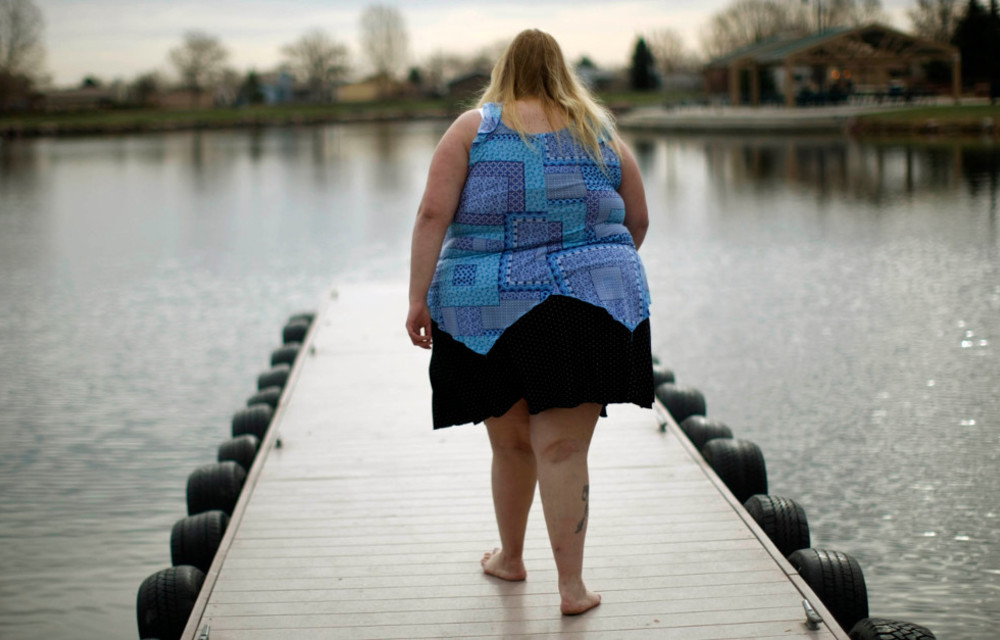 Widely cited statistics say South Africa trails the United States and Mexico in levels of obesity