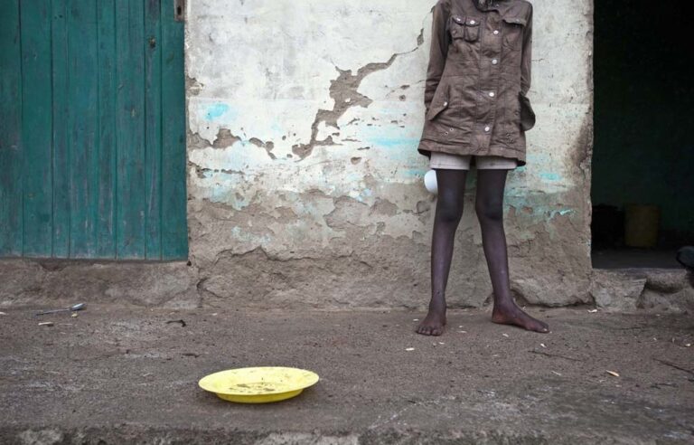 SA’s children poor and malnourished
