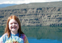 Light at the end of the scalpel for more targeted brain surgery 11-year-old Violet O’Dell had a large