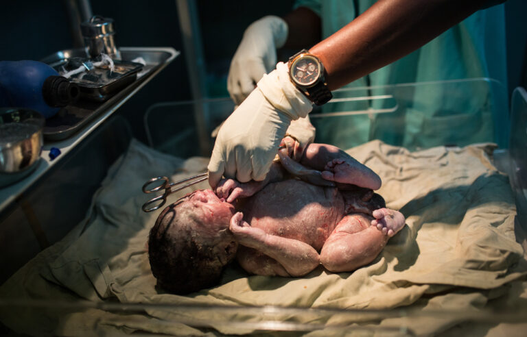 This map tells you which districts have the country’s highest c-section rates