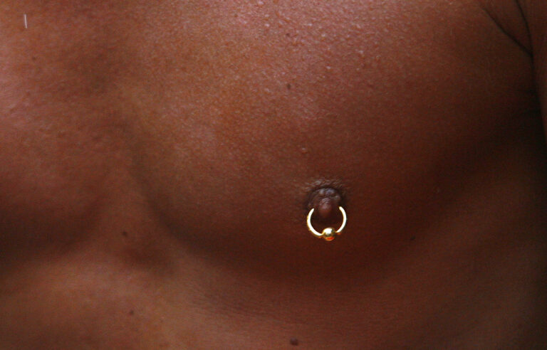 Are South African men more at risk of breast cancer?
