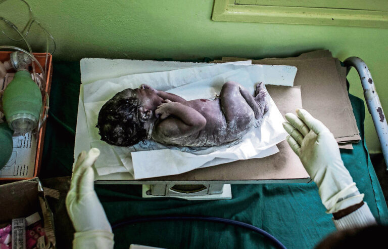 ​Technology speeds up diagnosis and HIV testing for babies in Mozambique