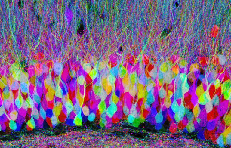 There’s gold at the end of the Brainbow