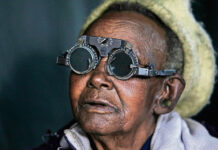 Truth about cataracts is plain to see: They can be treated Cataract surgery will become part of Madagascar's universal healthcare programme.