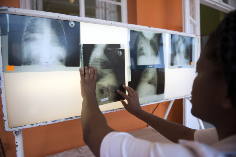 The SHINE trial – hope for shorter, kinder TB treatment for children