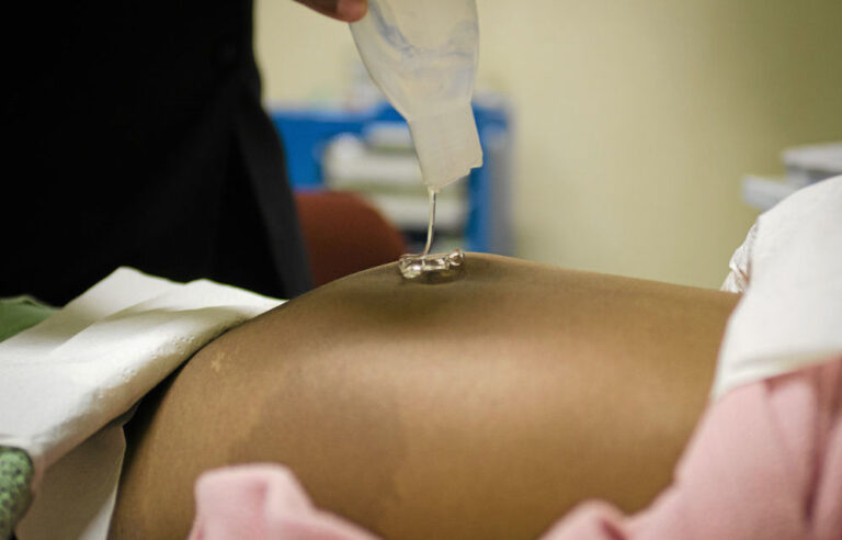 Five African states help women prevent pregnancy right after birth