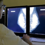 Mammography is still the gold standard of breast screening.