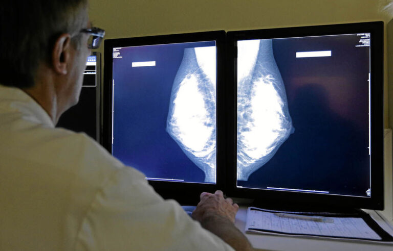 Mammograms still the gold standard of breast screening
