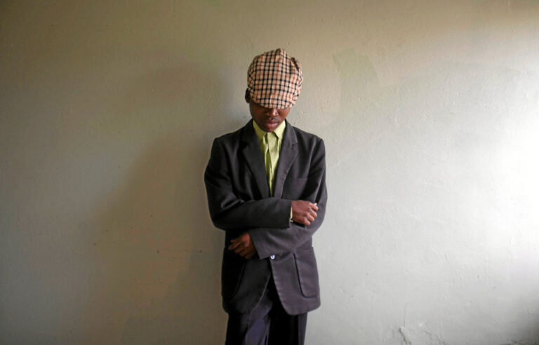 Talks on clear-cut solutions to circumcision initiated