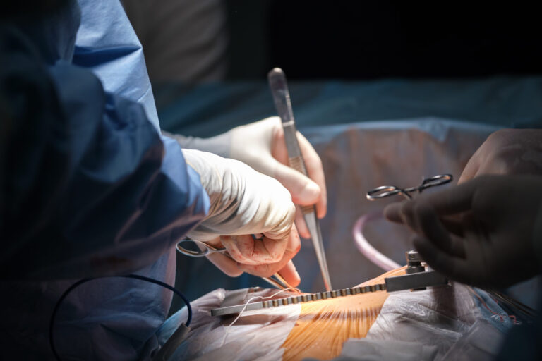 The eerily sophisticated system behind selling human organs