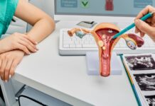 Health Beat #11 | Why do more Black SA women get cervical cancer than any other race in the country?