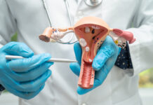 Why so many government patients get cervical cancer — and what to do about it