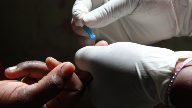 Trump ends SA’s HIV and TB research grants